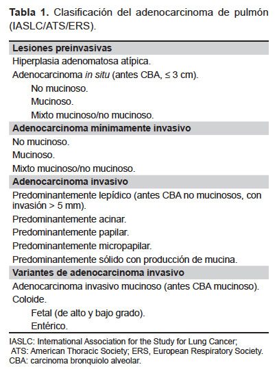 SciELO - Saúde Pública - Cáncer de pulmón, una revisión sobre el