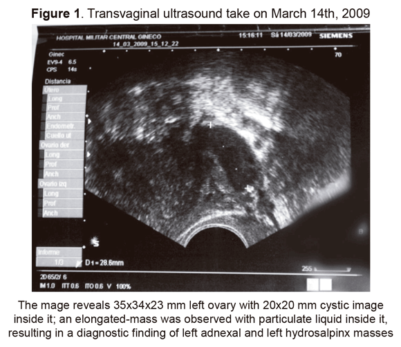 Scielo Saude Publica The Molecular Diagnosis Of Pelvic Tuberculosis A Case Report The Molecular Diagnosis Of Pelvic Tuberculosis A Case Report